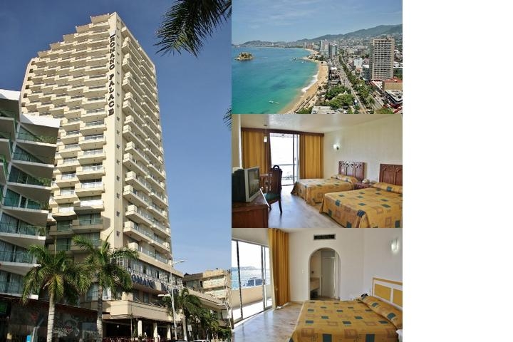 Hotel Romano Palace Acapulco photo collage