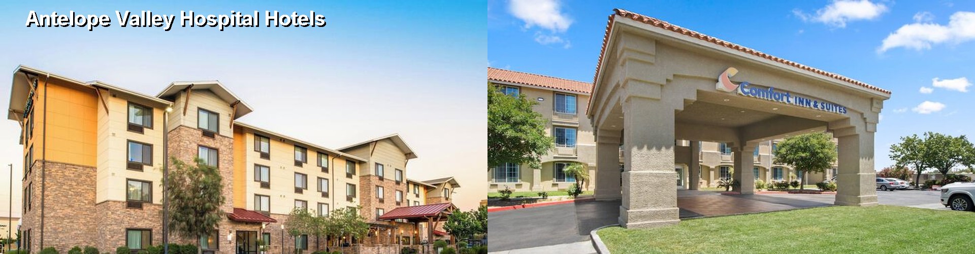 4 Best Hotels near Antelope Valley Hospital