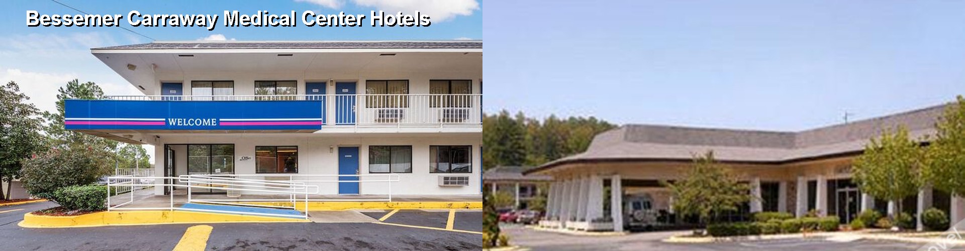 3 Best Hotels near Bessemer Carraway Medical Center