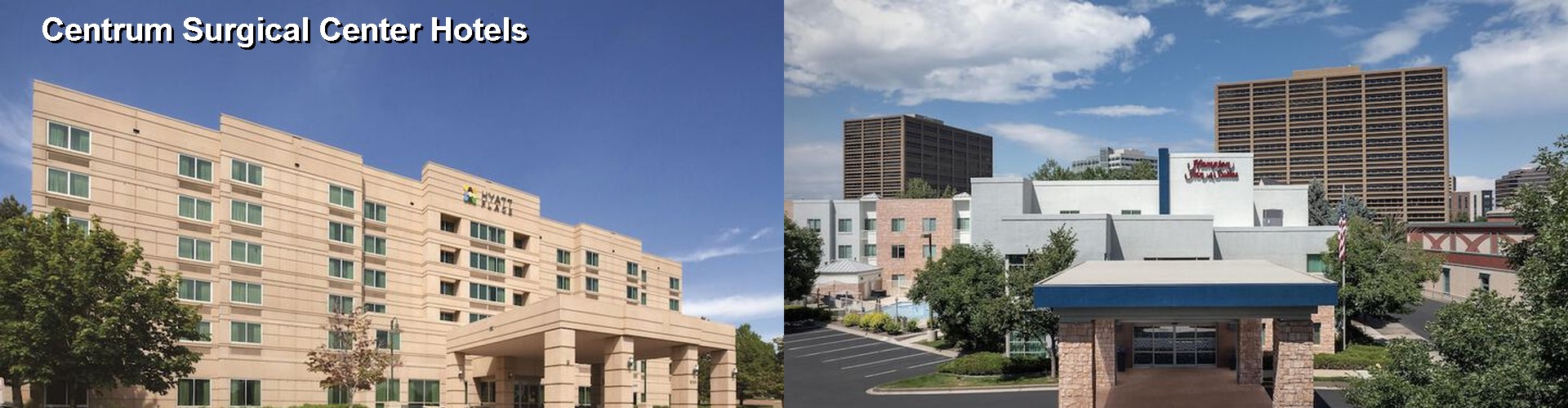 5 Best Hotels near Centrum Surgical Center