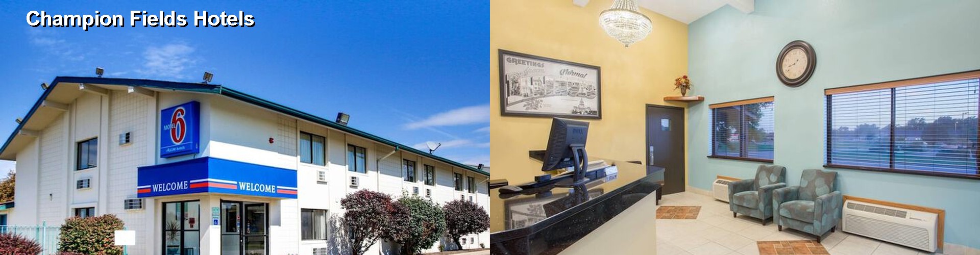 5 Best Hotels near Champion Fields