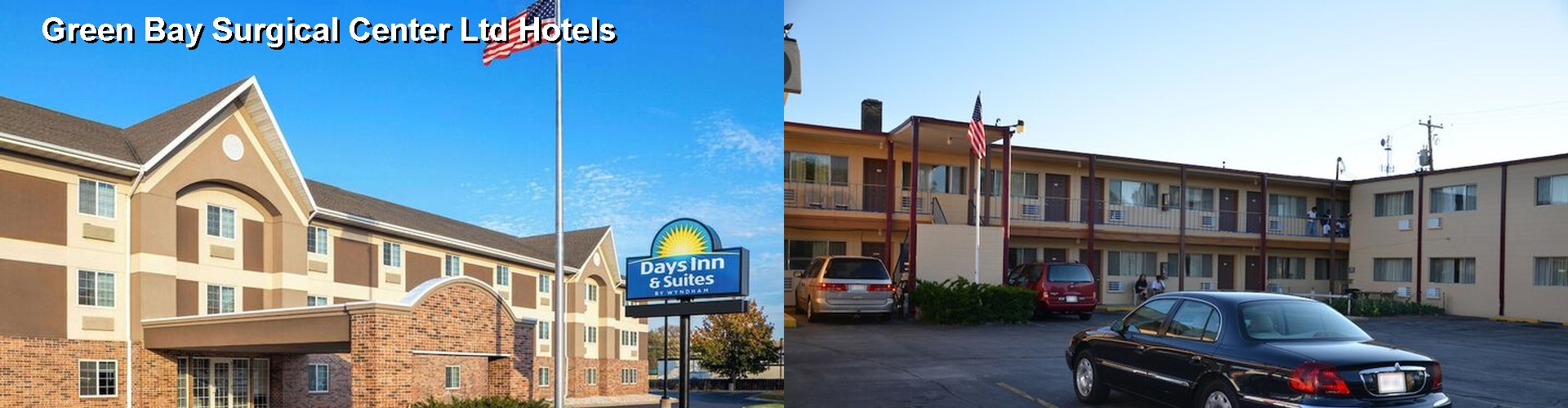 5 Best Hotels near Green Bay Surgical Center Ltd