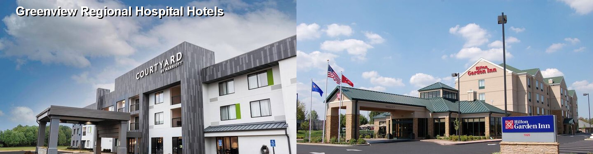 5 Best Hotels near Greenview Regional Hospital