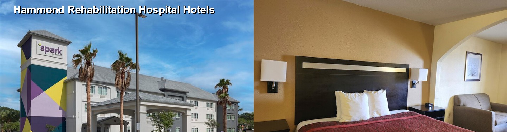 5 Best Hotels near Hammond Rehabilitation Hospital