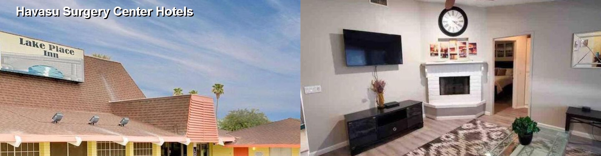 2 Best Hotels near Havasu Surgery Center