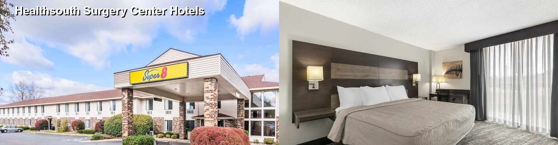 5 Best Hotels near Healthsouth Surgery Center