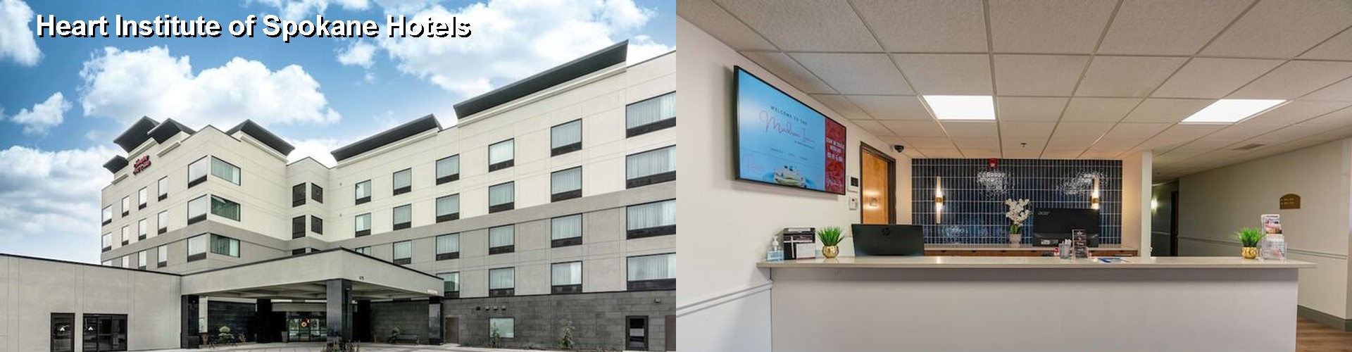 5 Best Hotels near Heart Institute of Spokane