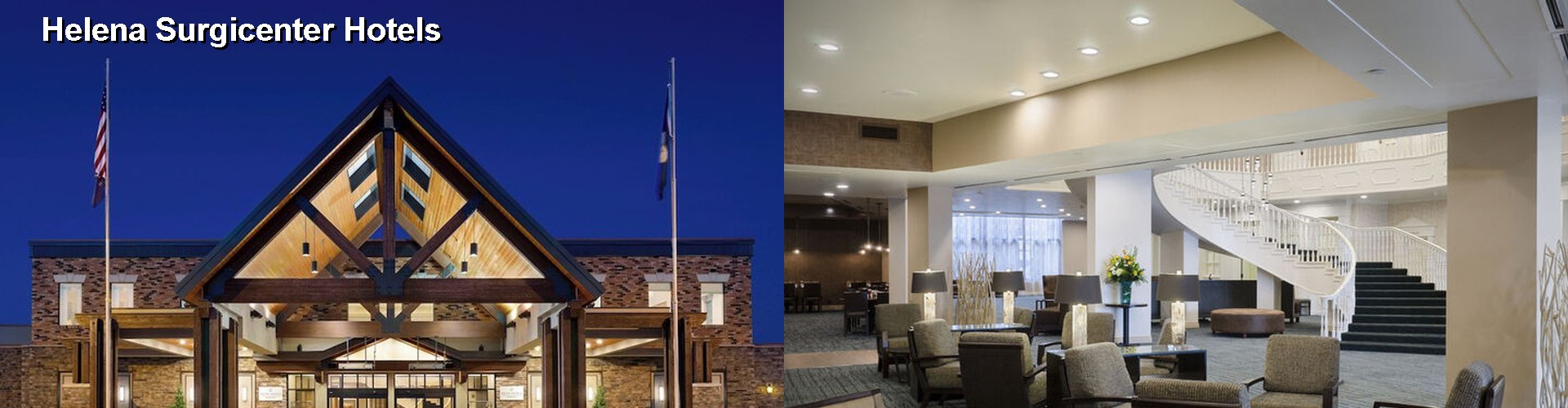 5 Best Hotels near Helena Surgicenter