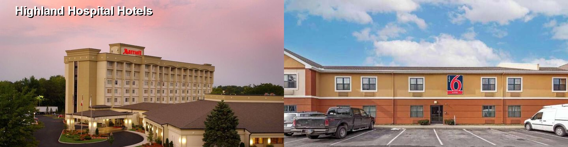 5 Best Hotels near Highland Hospital