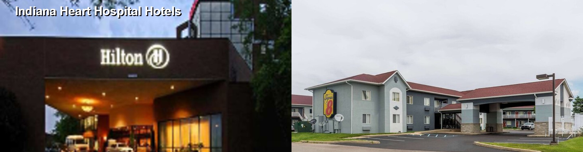 2 Best Hotels near Indiana Heart Hospital