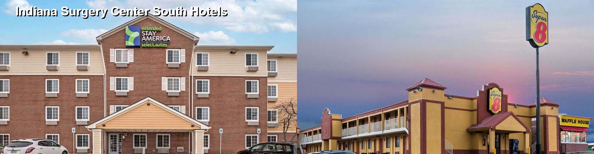 5 Best Hotels near Indiana Surgery Center South
