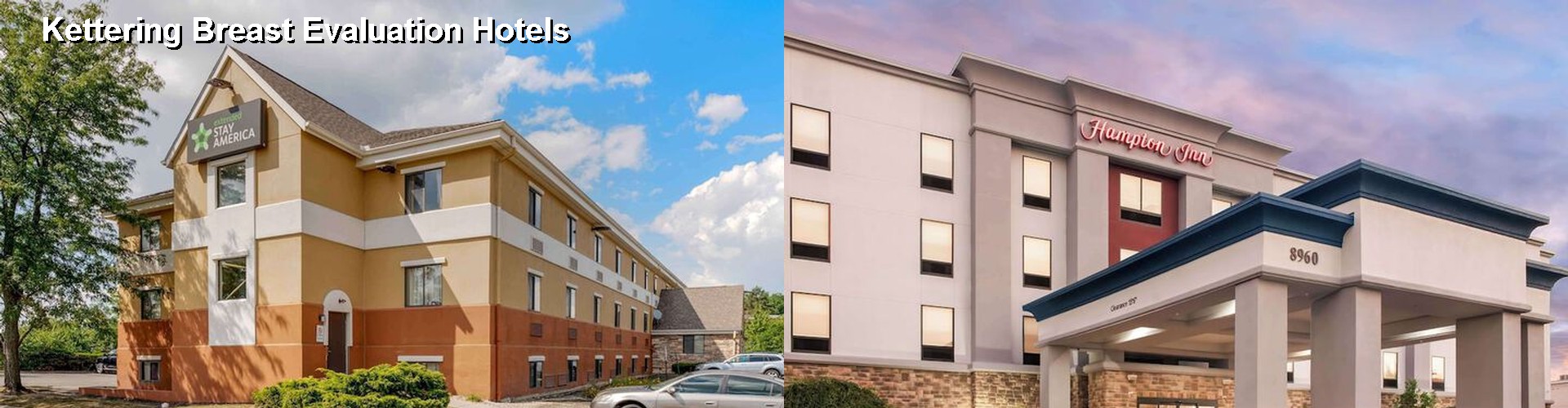 3 Best Hotels near Kettering Breast Evaluation