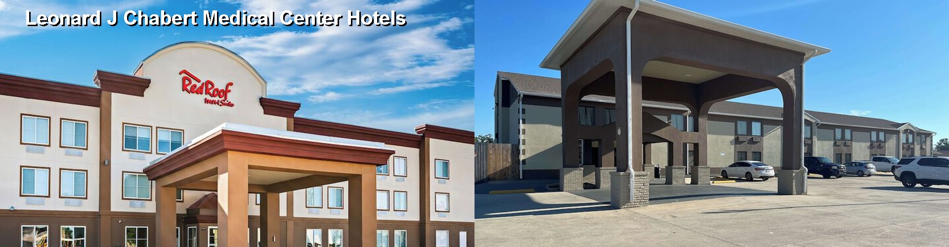 5 Best Hotels near Leonard J Chabert Medical Center