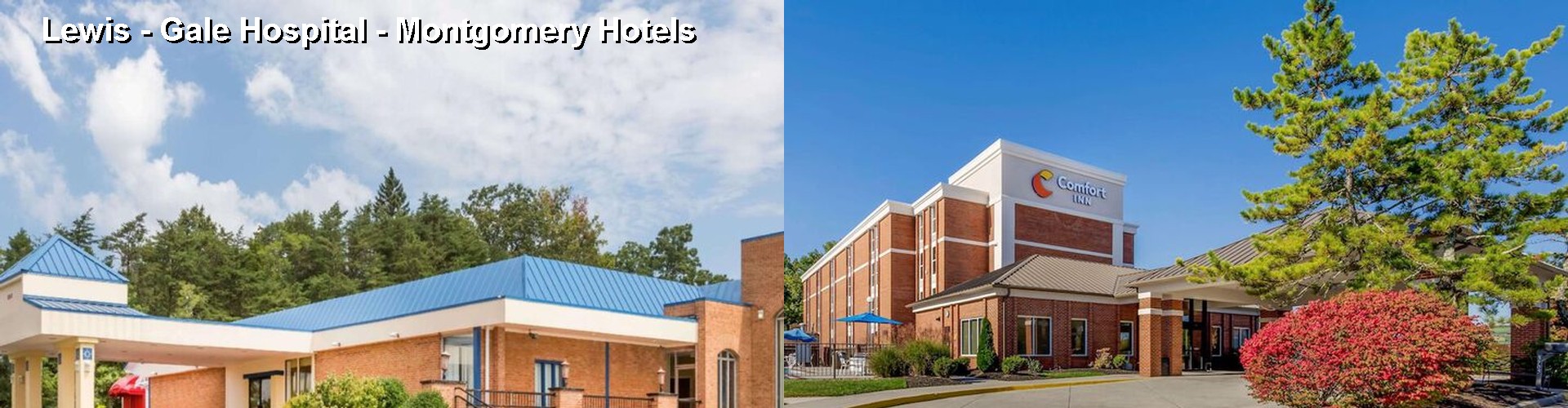 5 Best Hotels near Lewis - Gale Hospital - Montgomery