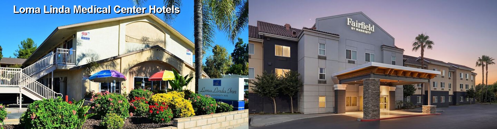 5 Best Hotels near Loma Linda Medical Center