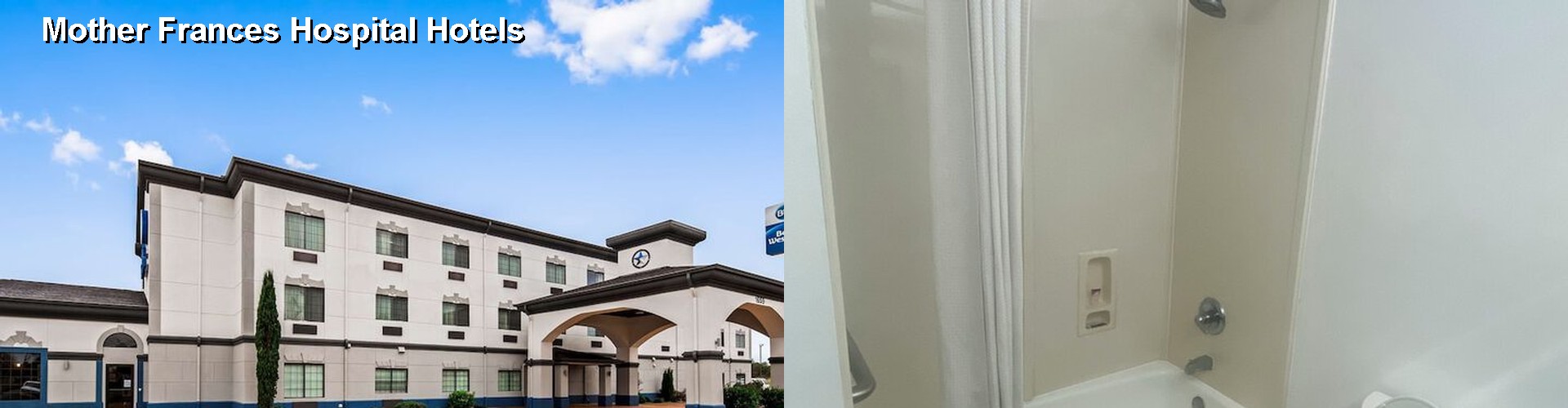 5 Best Hotels near Mother Frances Hospital