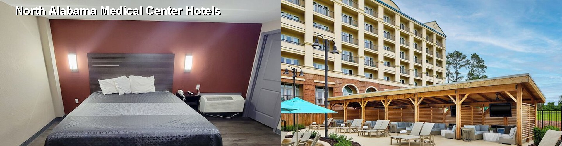 5 Best Hotels near North Alabama Medical Center
