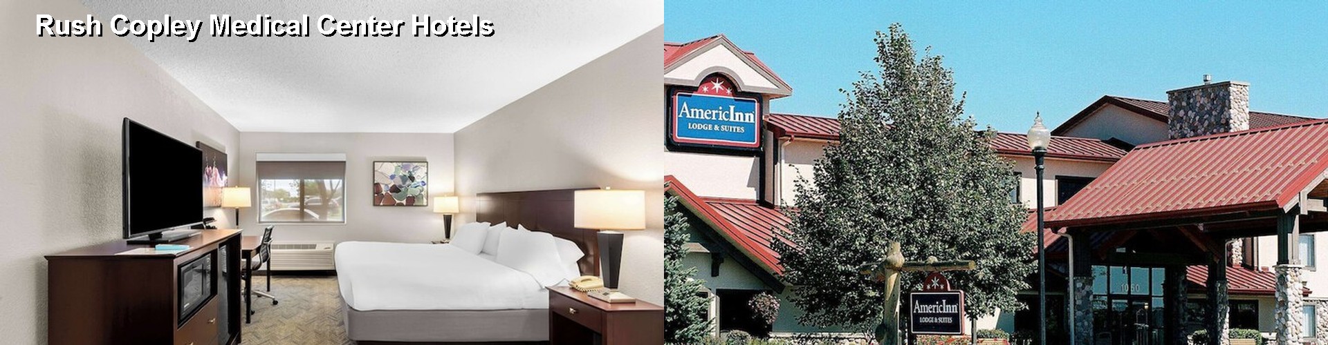 3 Best Hotels near Rush Copley Medical Center