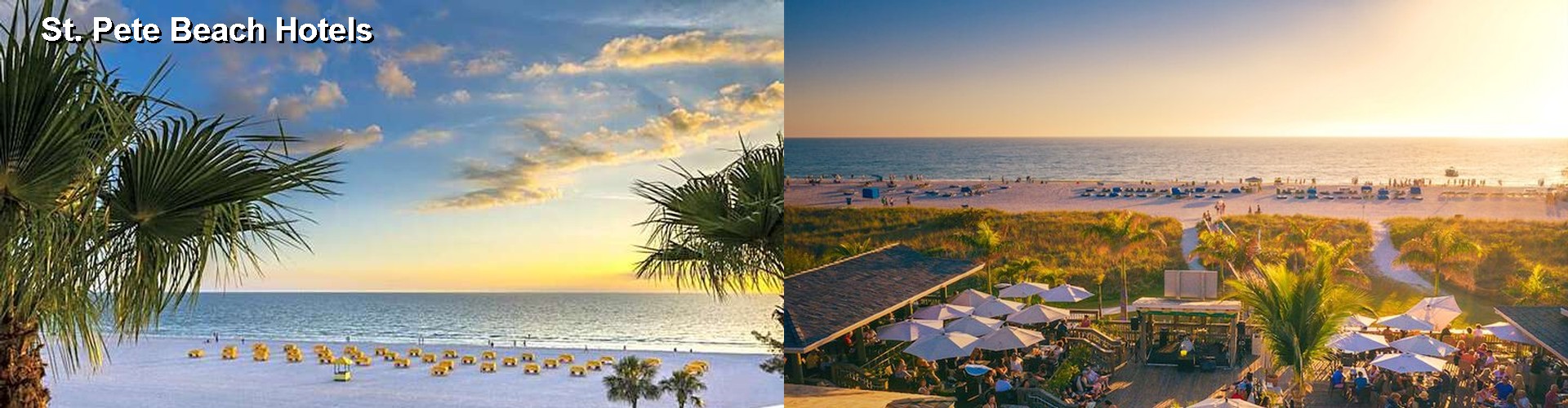 5 Best Hotels near St. Pete Beach