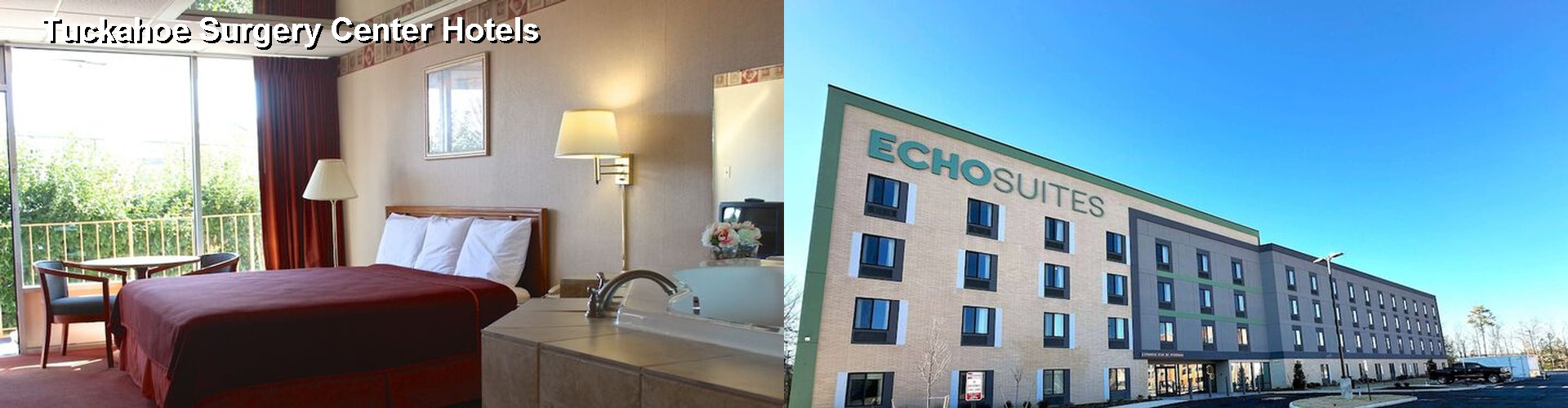 4 Best Hotels near Tuckahoe Surgery Center